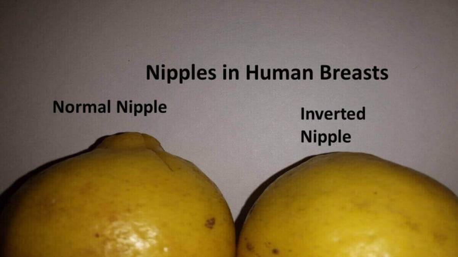Have inverted nipple make
